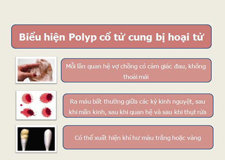 dấu hiệu polyp ở cổ tử cung bị hoại tử