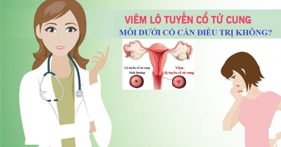 viêm lộ tuyến cổ tử cung môi dưới có cần điều trị không