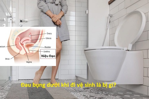 Cảnh giác với đau bụng dưới khi đi vệ sinh