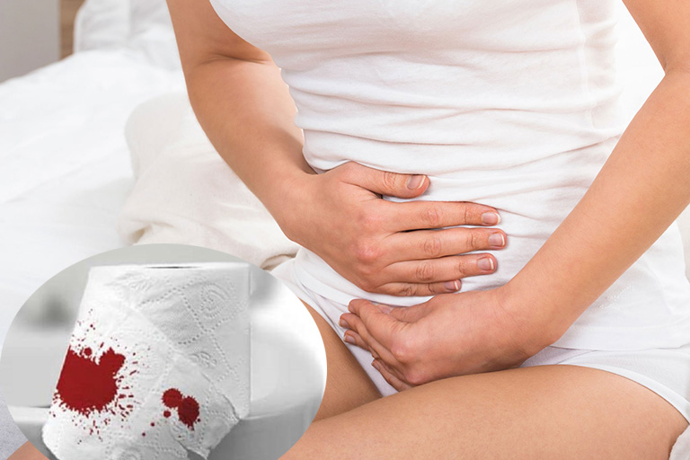 Đừng chủ quan khi bị đau bụng dưới đi ngoài ra máu 