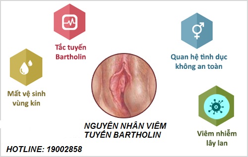 Top 4 thủ phạm gây viêm tuyến bartholin